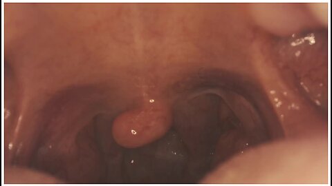 Get Swallowed! Mouth Tour Hd - Close Up (5 Min) Asmr Vore Giantess - Go Deep Down Her Throat!